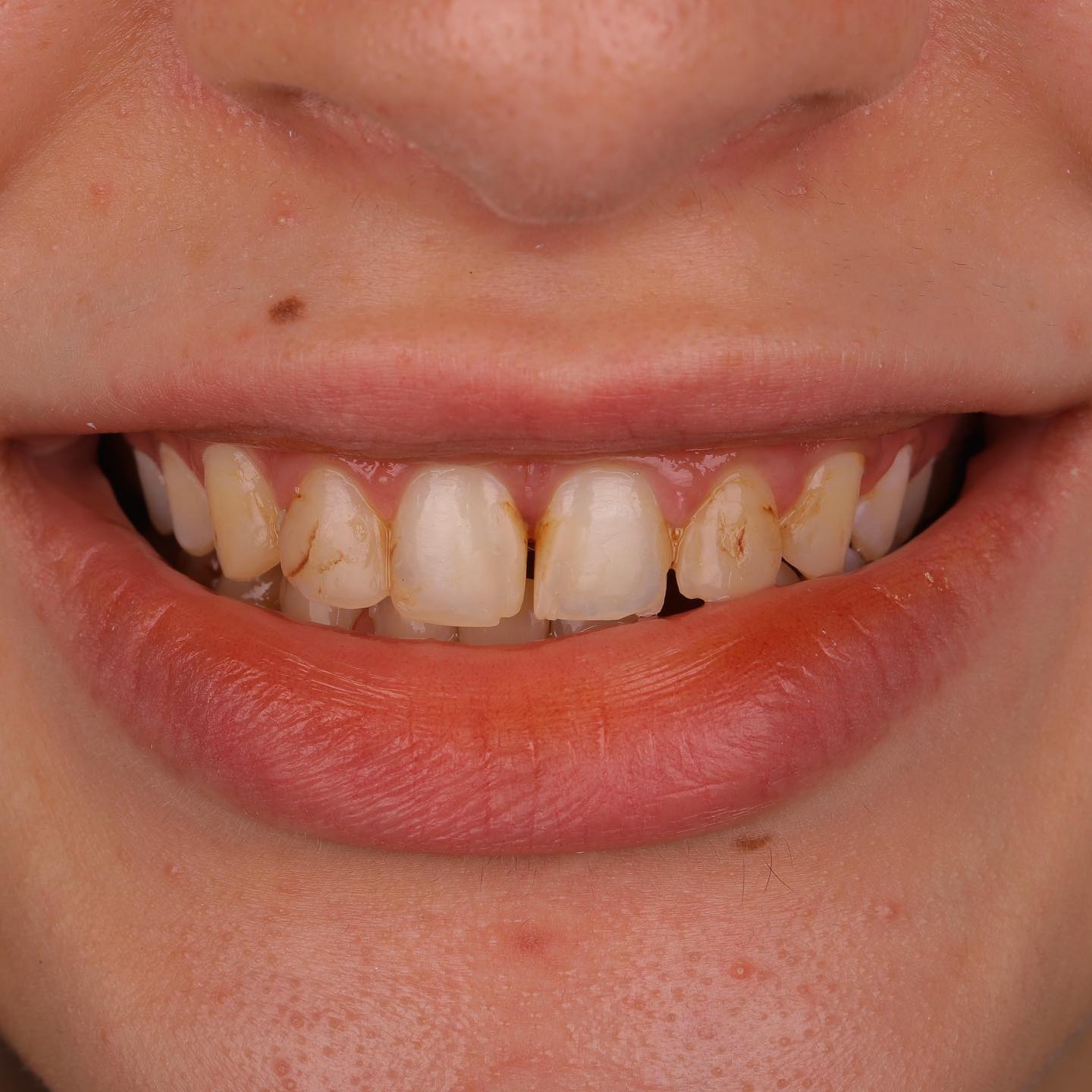 2648724879270080485_352545578_1