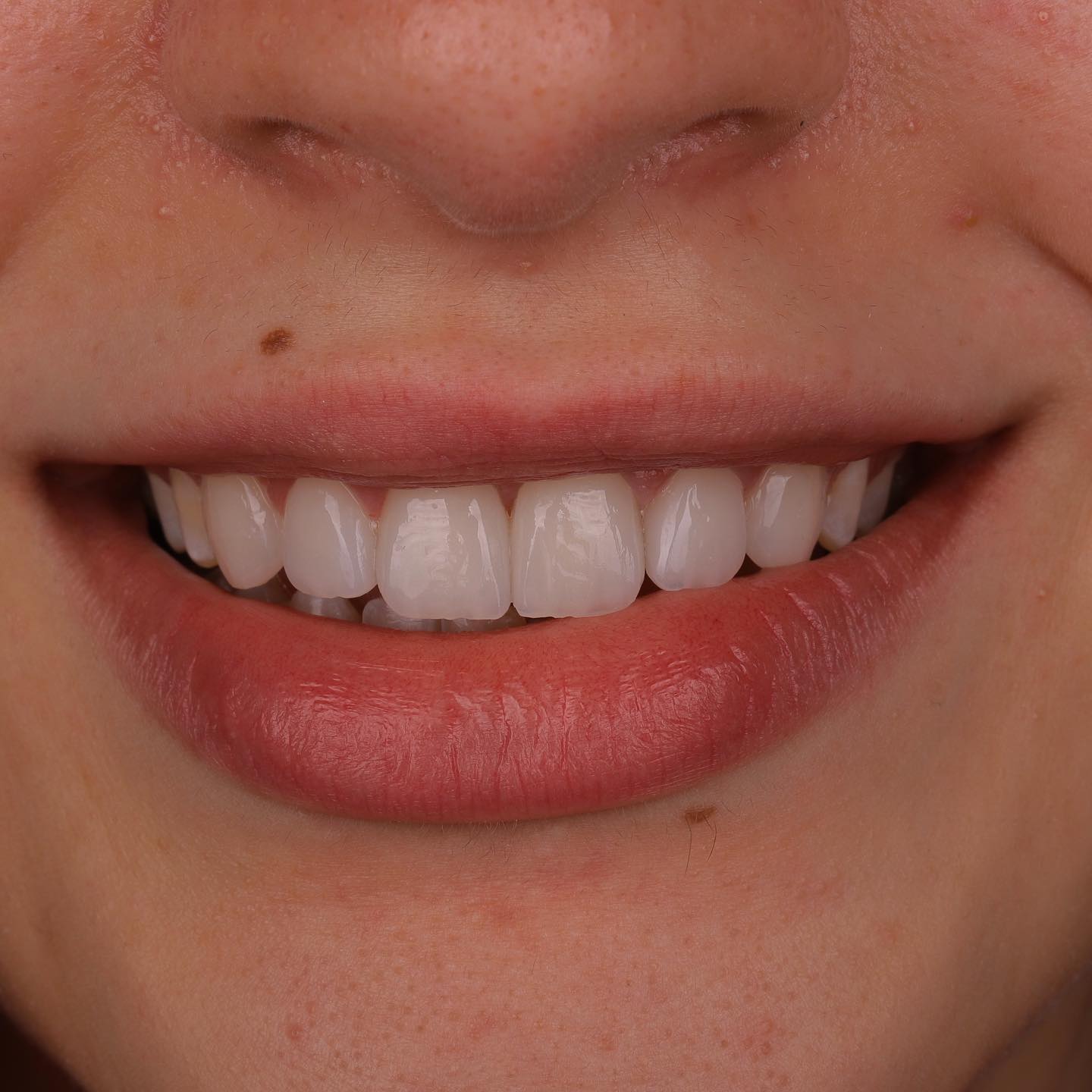 2648724879270080485_352545578_2